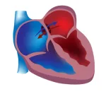 ادونس اینترونشن