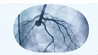 آنژیوگرافی تشخیصی عروق کرونر
